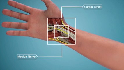 bd-ejercicos-para-aliviar-dolor-de-tunel-carpal-290630
