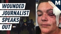 A wounded journalist speaks out — Mashable Originals