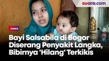 Bayi Salsabila di Bogor Diserang Penyakit Langka, Bibirnya 'Hilang' Terkikis