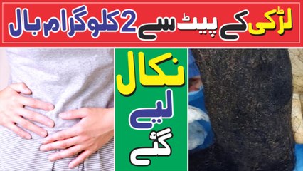 2 Kg Of Hair Was Removed From The Girls Abdomen