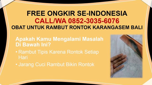 LUAR BIASA AMPUH, CALL/WA 0852-3035-6076, Obat Penumbuh Rambut Rontok Karangasem Bali
