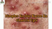 Pimples Ko Dur Karne Ka Gharelu Upay