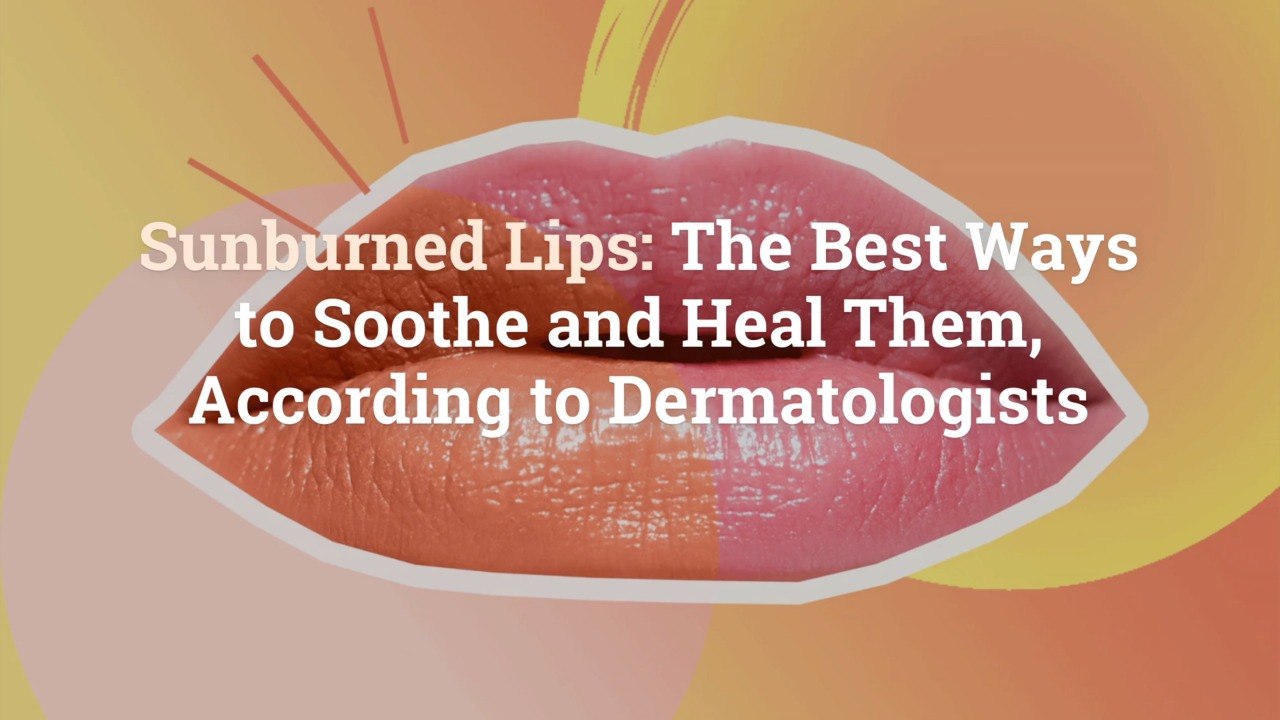 Sunburned Lips The Best Ways To Soothe And Heal Them According To