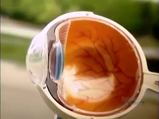 How Its Made - 079  Laser Eye Surgery