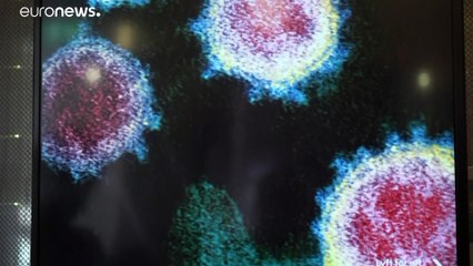 "Contagious" - eine Ausstellung will Hoffnung machen