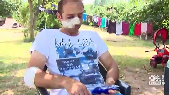 Sakarya'daki patlamadan yaralı kurtulan işçi dehşet anlarını anlattı | Video