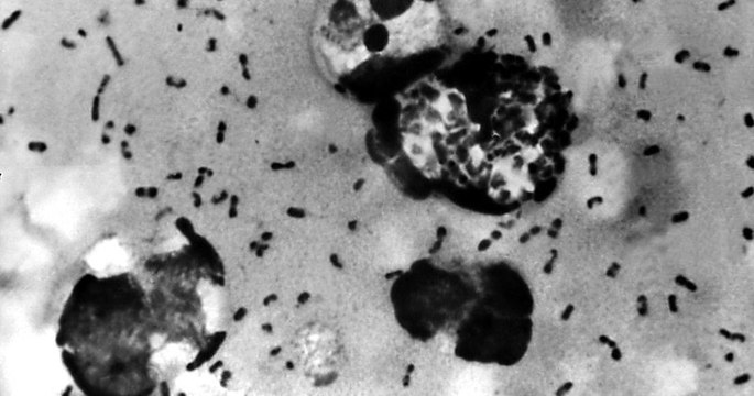 La Chine prend des mesures de précaution après la découverte d'un cas suspect de peste bubonique