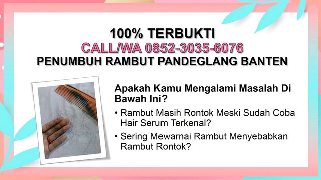 FREE ONGKIR SE-INDONESIA, CALL/WA 0852-3035-6076, Obat Untuk Rambut Rontok Pandeglang Banten