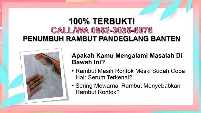 PALING LAKU DI 2020, CALL/WA 0852-3035-6076, Obat Penumbuh Rambut Pandeglang Banten