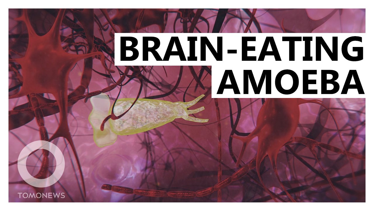 Brain-Eating Amoeba: Florida Issues Warning After Infection