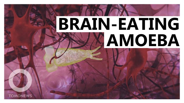 Brain-Eating Amoeba: Florida Issues Warning After Infection