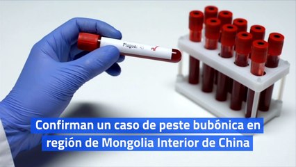 Confirman un caso de peste bubónica en región de Mongolia Interior de China