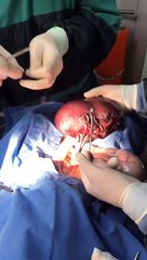 KEDİ PYOMETRA AMELİYATI.