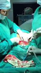baby Cesarean Operation
