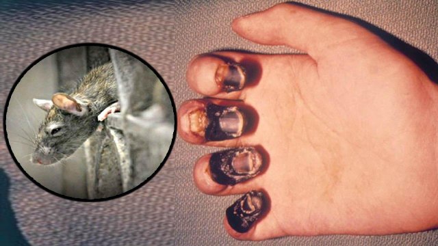 China में Corona Virus के बाद मिला एक और नया खतरनाक Virus, Bubonic Plague के मिले मरीज | Boldsky