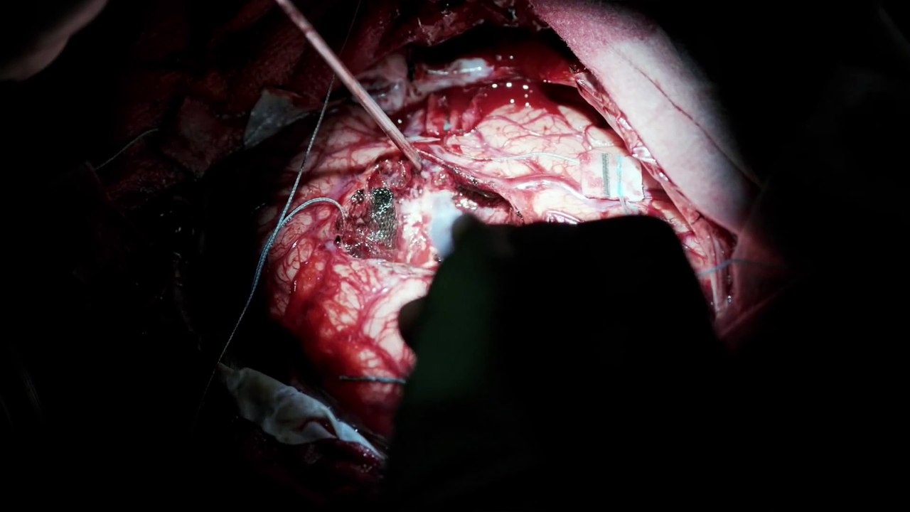 Los avances médicos que cambiarán nuestras vidas