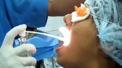 bd-porque-hay-mal-aliento-a-pesar-del-lavado-de-dientes-090720