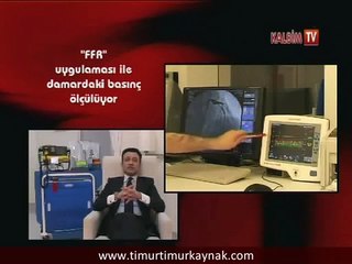 STENT HANGİ DURUMLARDA GEREKLİDİR?