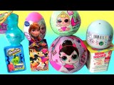 LOL Dolls Pees Spits -- LOL Lil Outrageous Littles Surprise - Shimmer and Shine Toys NUM NOMS 4.1