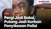 Pergi Jadi Saksi, Pulang Jadi Korban Penyiksaan Polisi