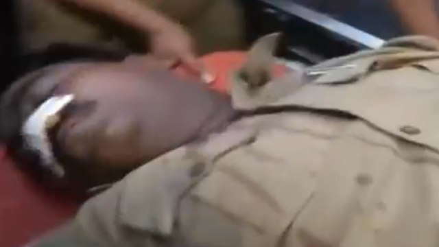 Vikas Dubey encounter, Injured cops shifted to hospital