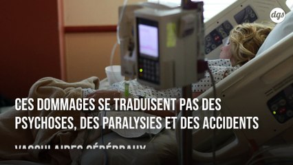 Des lésions cérébrales détectées chez des malades du Covid-19 présentant peu de symptômes