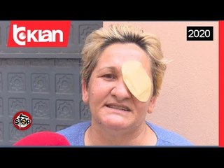 Stop-Aksidenti/Shtetasja fluturon ne rruge , komisioni e vlereson 90 % te demtuar! (24 Qershor 2020)