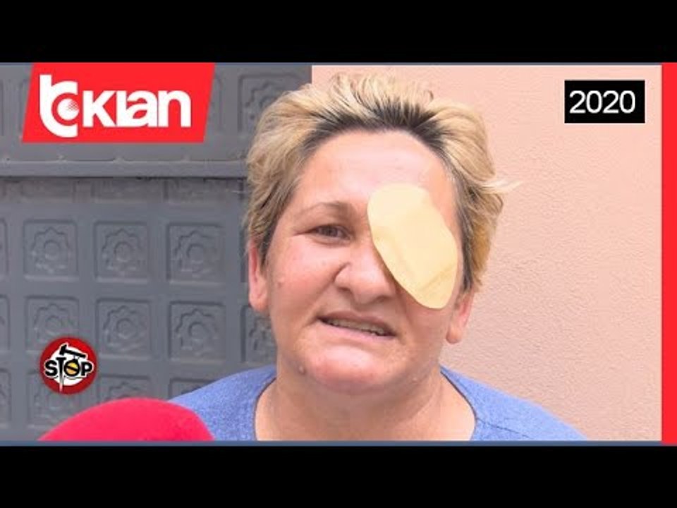 Stop-Aksidenti/Shtetasja fluturon ne rruge , komisioni e vlereson 90 % te demtuar! (24 Qershor 2020)