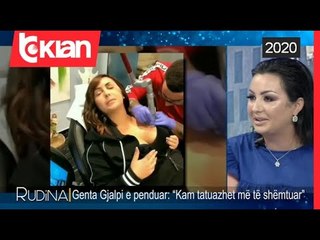 Genta Gjalpi do te heqe te gjitha tatuazhet-Rudina