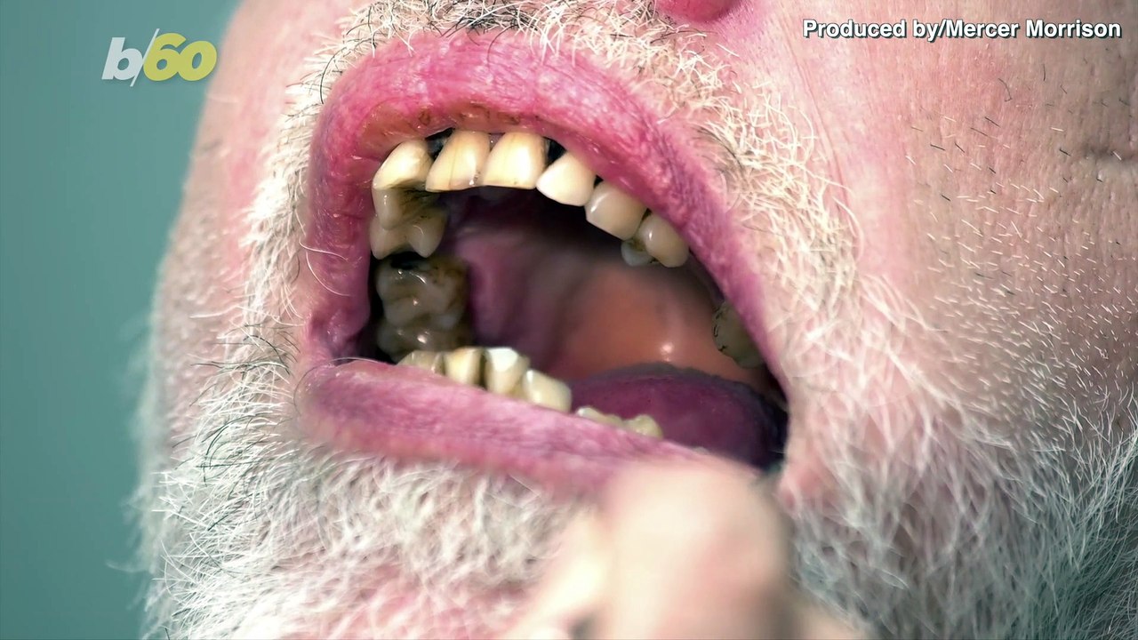 Make Sure Not to Eat These Foods Before Your Next Dental Appointment!