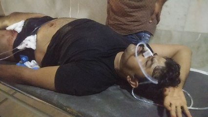 पुलिस व आरोपी में आमने-सामने फायरिंग, दो गोली लगने पर आरोपी घायल