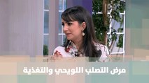 مرض التصلب اللويحي والتغذية  - د.ربى مشربش - التغذية