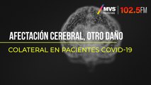 Afectación cerebral, otro daño colateral en pacientes Covid-19