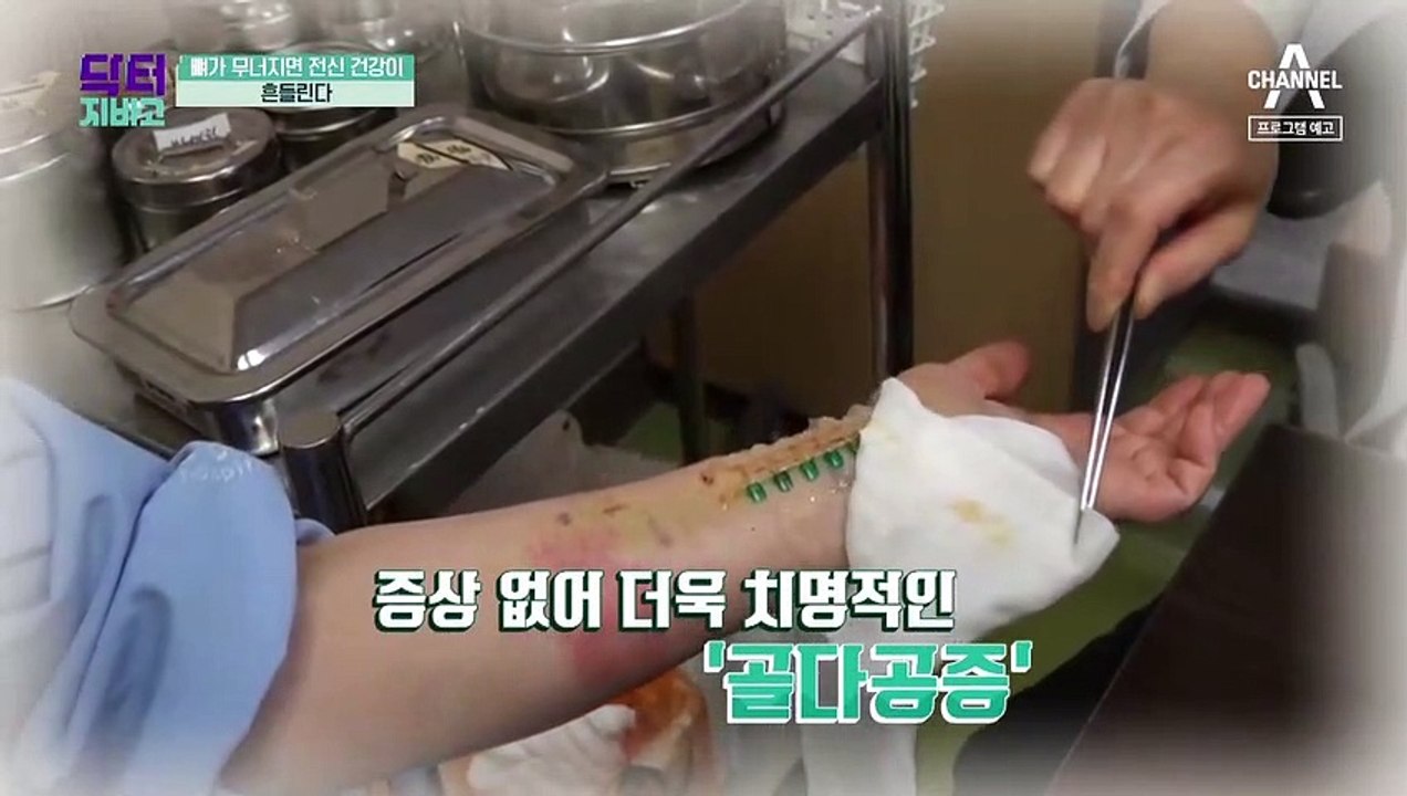 [예고] 뼈가 무너지면, 전신 건강이 흔들린다!