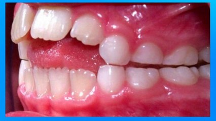 bd-habitos-orales-en-niños-170720