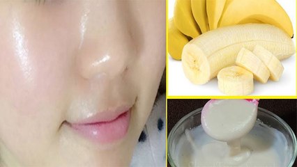 Skin Care: पके-गले केले का चेहरे पर करें इस्तेमाल, 5 मिनट में दमक उठेगा चेहरा । Boldsky
