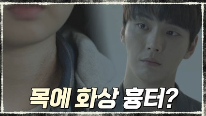 (떡밥)살아있는 이지영 목에도 화상 흉터가..? 윤시윤 촉♨