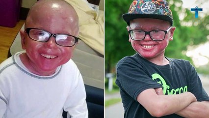 Top 10 Unusual Kids Who Growing Too Fast From Their Age Born Different