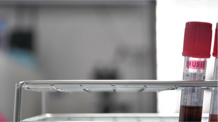 How To Determine Your Blood