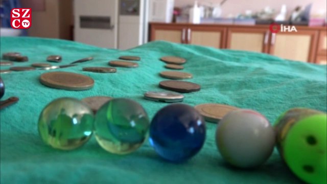 Çocukların midesinden çıkan onlarca yabancı cisim şaşırttı