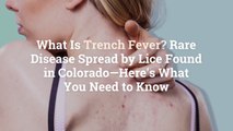 What Is Trench Fever? Rare Disease Spread by Lice Found in Colorado—Here's What You Need t