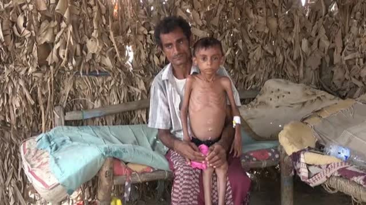 2,5 millones de niños, en riesgo de morir de hambre en Yemen