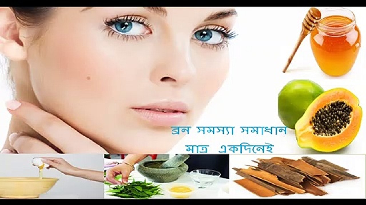 How To Remove Pimples Overnight ।। pimples ।। pimple remover।। pimple cure ।।  Beauty tips