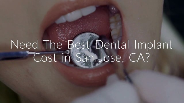 The Glen Dental : Dental Implant Cost in San Jose