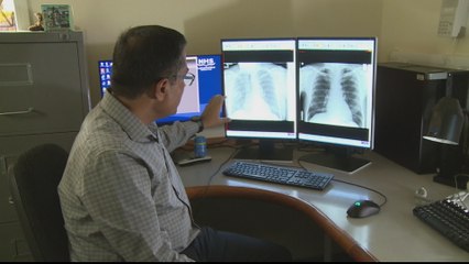 Potential long-term effects of COVID-19 on human beings