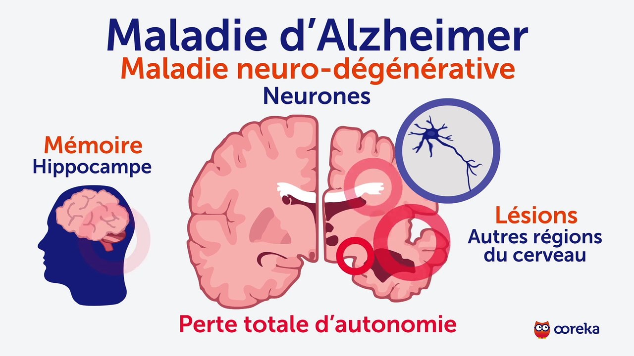 Alzheimer : symptômes, facteurs de risque, traitements - Vidéo Dailymotion