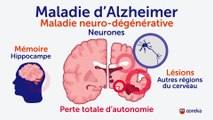 Alzheimer : symptômes, facteurs de risque, traitements