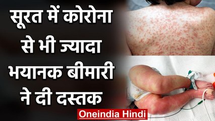 Gujarat के Surat में क्या Coronavirus से भी ज्यादा भयानक बीमारी आई सामने ? वनइंडिया हिंदी