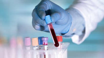 New Blood Test Can Detect Cancer Early