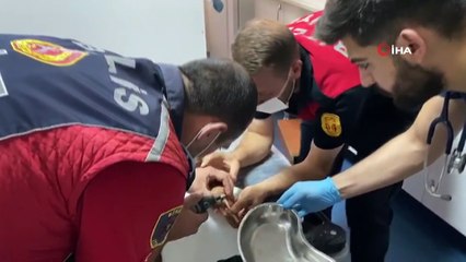 Küçük çocuğun parmağındaki yüzük kesilerek çıkarıldı